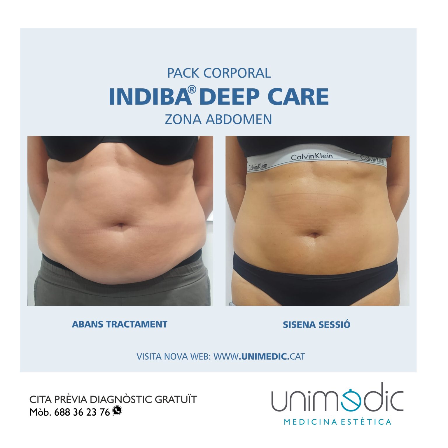 UNIMEDIC Indiba deep care abdomen